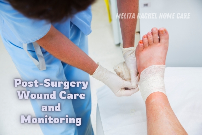 Home nurse dressing a post-surgery care and recovery monitoring by Melita Rachel Home Care Services in Pollachi